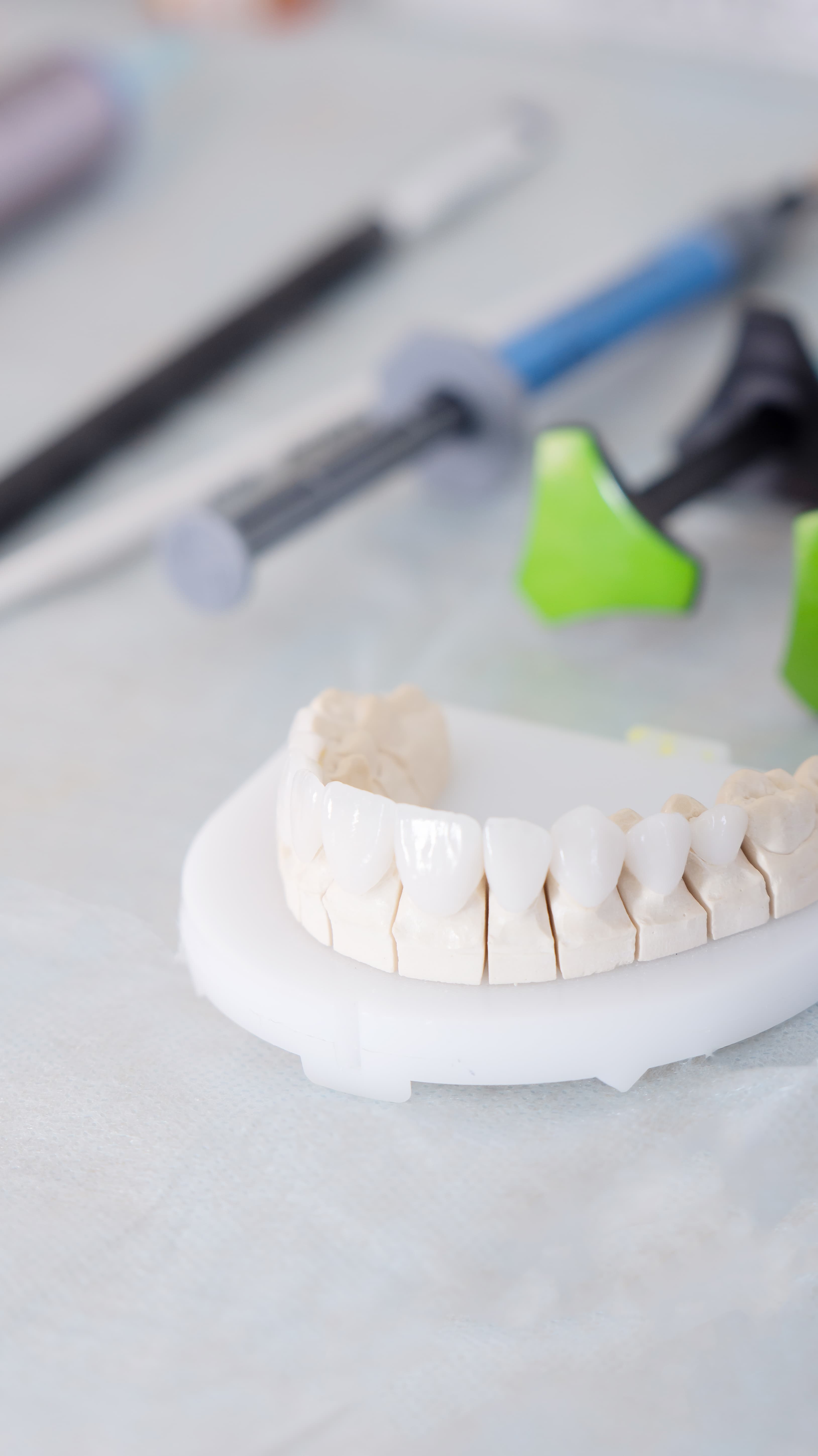 Implant — digital guide procedure detail
