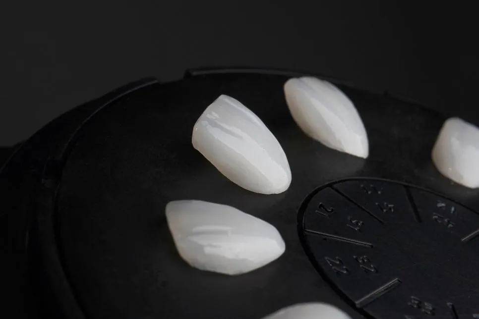 Veneers in Apgujeong: Why the Amount of Tooth Reduction Matters